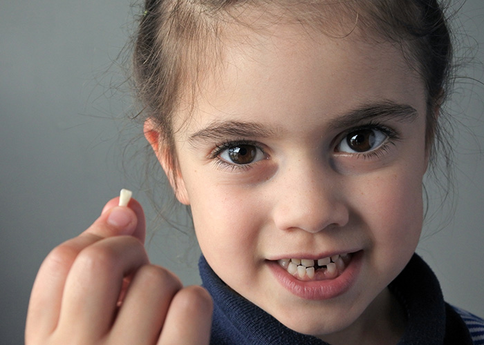 Texas Super Smiles for Kids | Fluoride Treatment, Sedation Dentistry and Teeth Bleaching