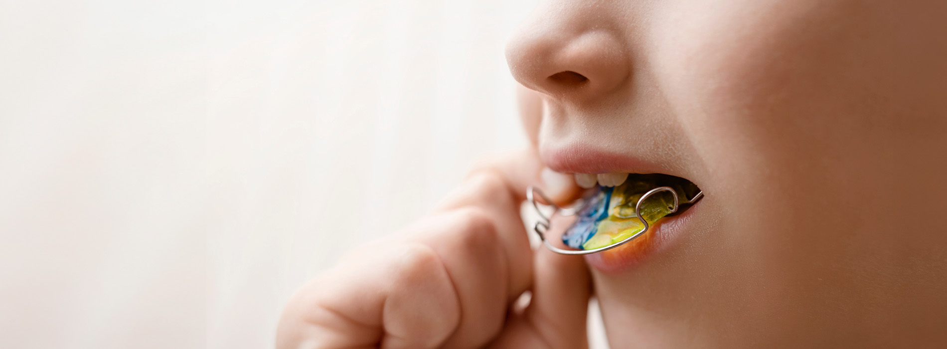 Texas Super Smiles for Kids | Dental Fillings, Periodontal Treatment and Orthodontics