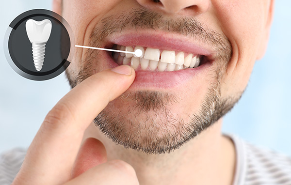 Texas Super Smiles for Kids | Root Canals, Cosmetic Dentistry and Extractions