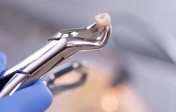 Texas Super Smiles for Kids | Adult Dentistry, Cosmetic Dentistry and Sedation Dentistry